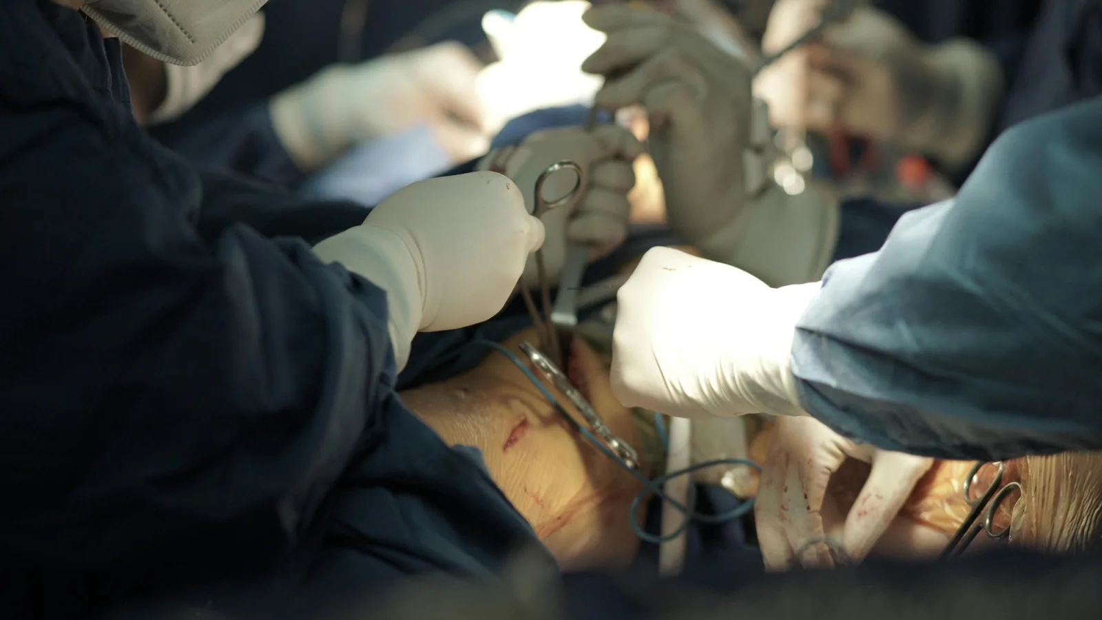 Bone and Tumour Surgery Lucknow
