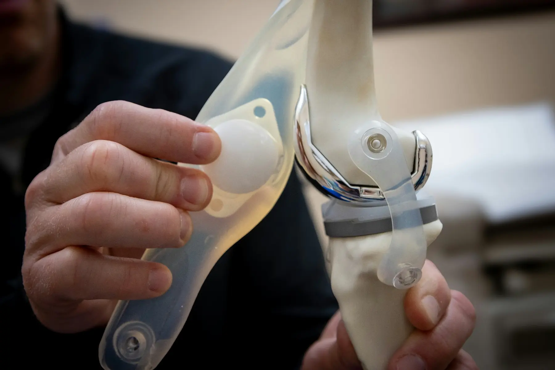 Knee Replacement Surgery Lucknow