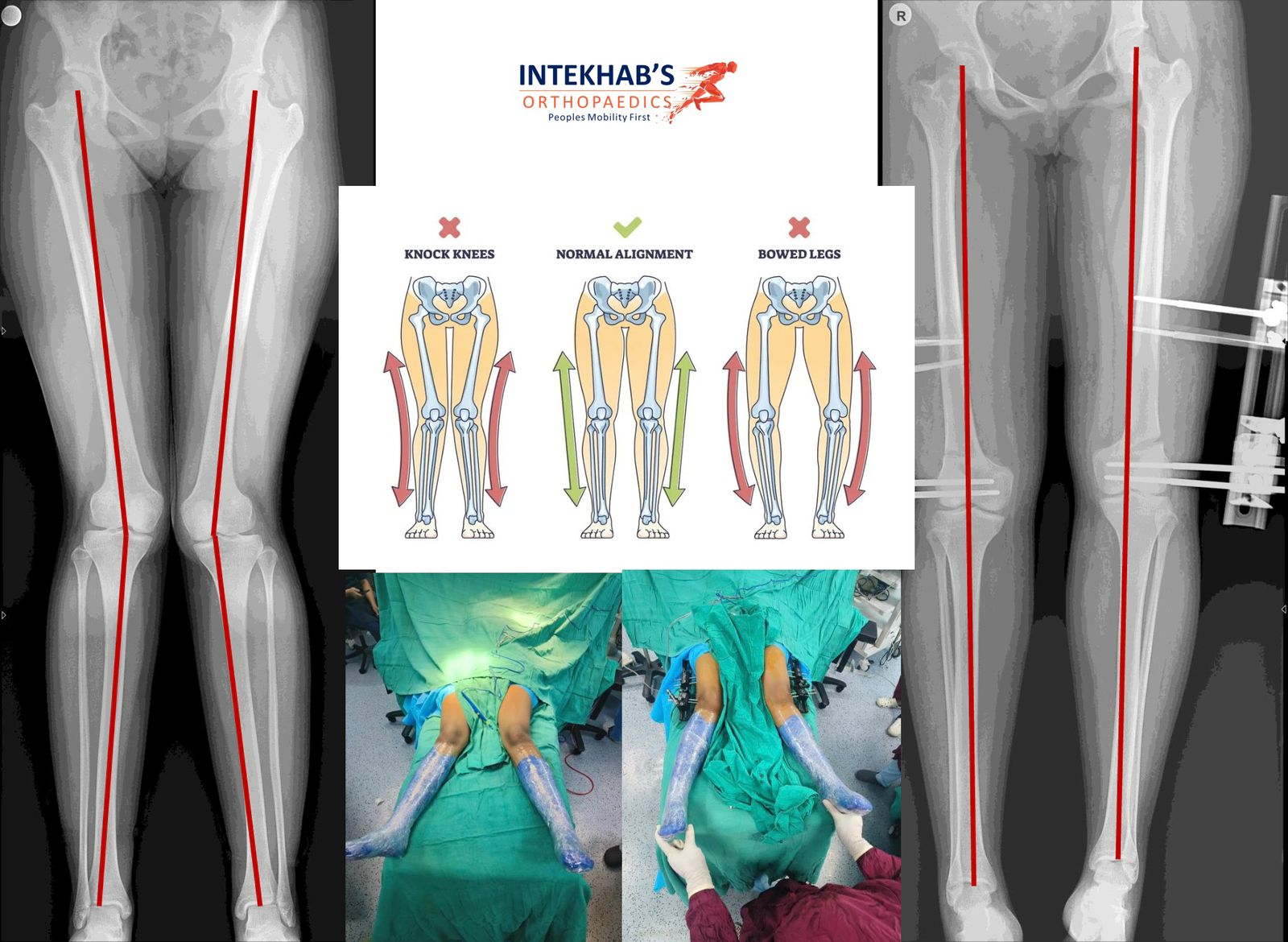 ArthritisCare
